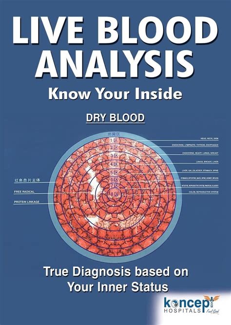 live blood drop test|Live Blood Analysis – ImmunoCeutica.